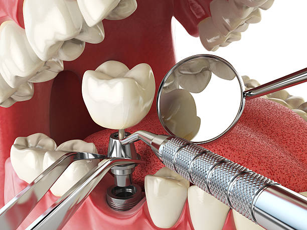 Best Emergency Tooth Extraction in Jonesboro, AR